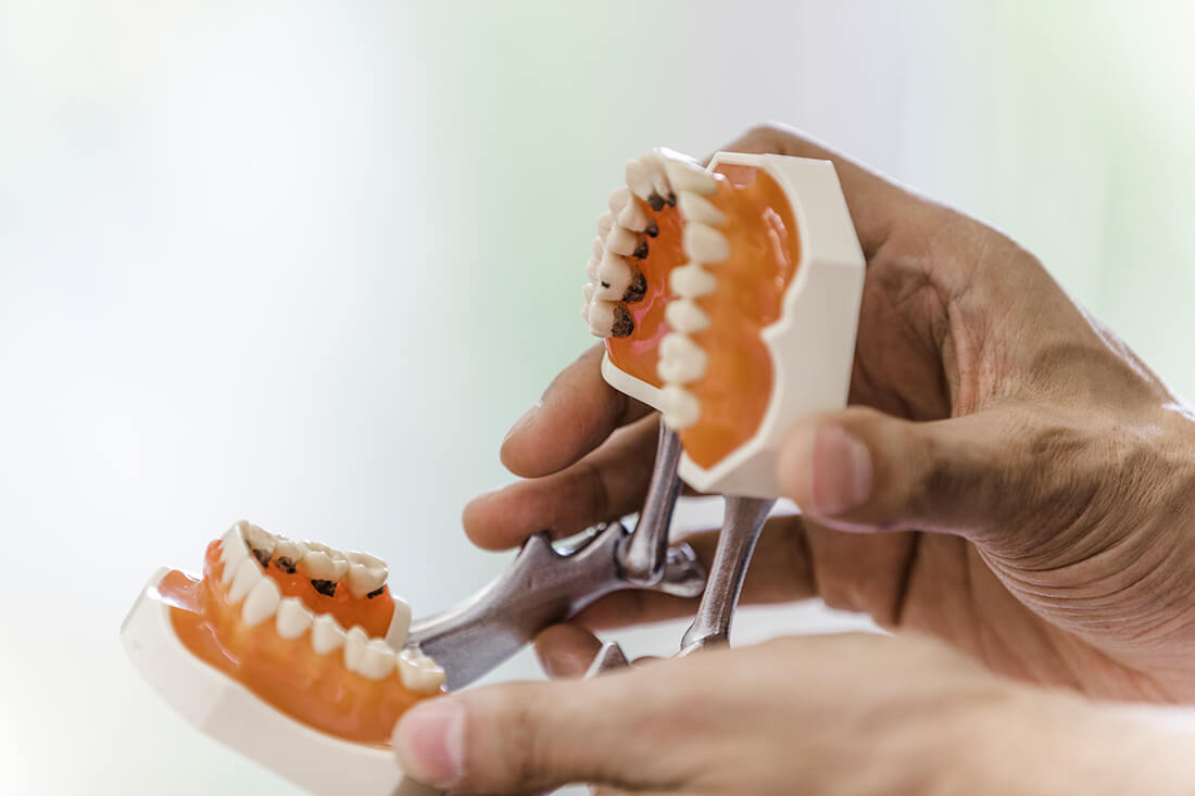 Zahnarzt Viersen - Implantologie - Praxis Dr. Guen